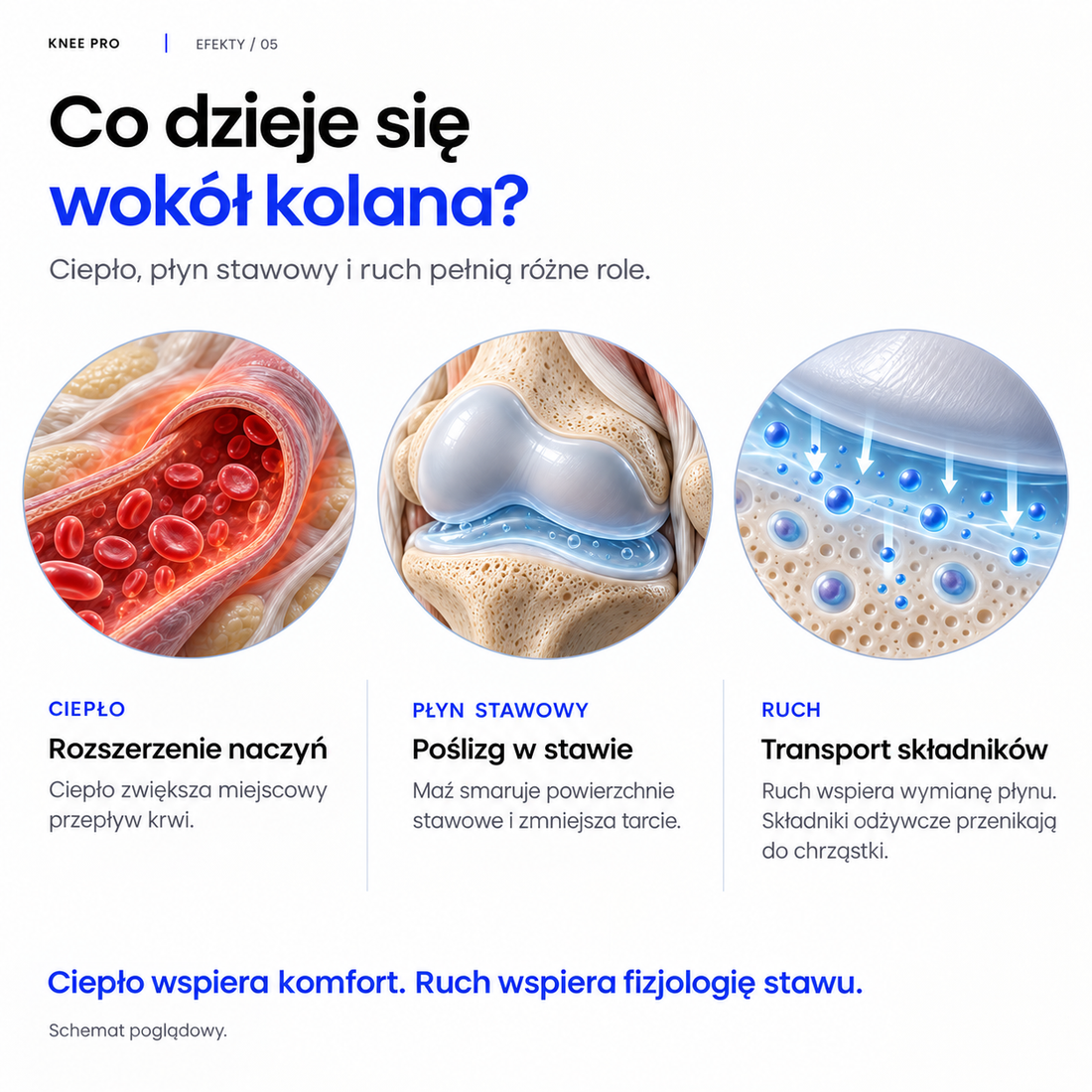 Schemat: co dzieje się wokół kolana